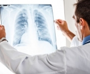 Care sunt cauzele pneumoniei