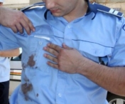Politist in strare grava la spital, dupa ce a fost lovit in cap cu o caramida