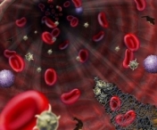 Grupa de sange poate sa-ti arate daca faci cancer? Iata ce spune un medic renumit!
