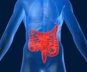 Boala Crohn - simptome si factori de risc