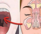 Cum sa iti desfunzi sinusurile in doar 20 de secunde folosind limba si degetele!