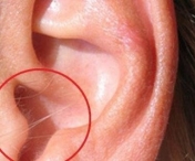 Ce boli risca persoanele care au par in urechi