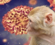 A fost descoperit al treilea caz de variola maimutei in Romania