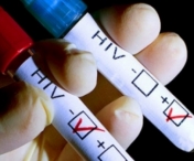 A fost identificata originea virusului HIV