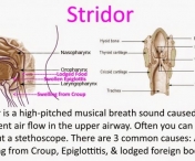 VIDEO - Stridorul: sunetul care trebuie sa te trimita urgent la medic