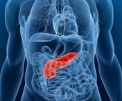 Cancerul de pancreas poate fi tratabil cu ajutorul unei metode inedite