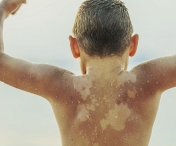 Cele mai frecvente boli la copii pe timpul verii. Sfatul medicilor