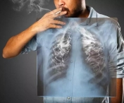 694 de cazuri de cancer pulmonar diagnosticate în primele şase luni ale anului la Institutul "Marius Nasta"