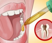 Scapa de durerile de dinti in cateva secunde! Foloseste aceasta solutie naturala…
