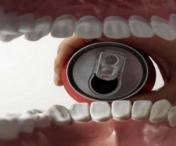 VIDEO - Ce se intampla cu dintii tai atunci cand bei Coca-Cola