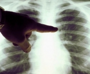 Cea mai mare greseala a fumatorului care creste riscul de cancer la plamani