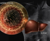Hepatita D. Factori de risc si simptome