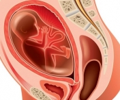 Femeile cu uterul retrovers raman mai greu insarcinate?