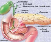 Factorii de risc ai pancreatitei