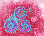 Unul din trei bărbaţi cu vârsta de peste 15 ani este infectat cu cel puţin un tip de papilomavirus uman genital