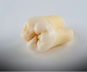 Știi ce se întâmplă cu corpul tău atunci când pierzi un singur dinte?