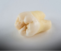 Știi ce se întâmplă cu corpul tău atunci când pierzi un singur dinte?