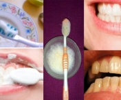 Albeste-ti dintii in numai 2 minute! Amestecul de care nici un stomatolog nu-ti va spune vreodata