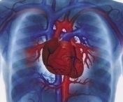 Cauzele insuficientei cardiace