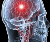 Cum recunoastem simptomele accidentului vascular cerebral