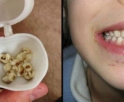 Incredibil! De ce sa nu mai arunci niciodata dintii de lapte ai copiilor!