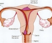 Primele semne ca o femeie are ovarele inflamate