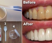 Cum sa-ti albesti dintii acasa - Fara stomatolog