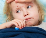 30 de copii cu rujeola internati la Spitalul de Boli Infectioase din Timisoara